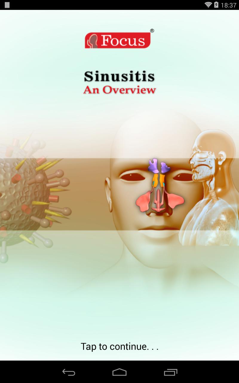 Sinusitis